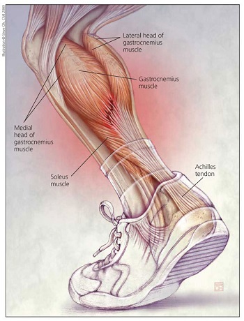 There is a God! Is There a Better Explanation for the Complexity of Tendons?